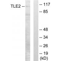 Western blot analysis of extracts from LOVO cells, using TLE2 antibody #33855.