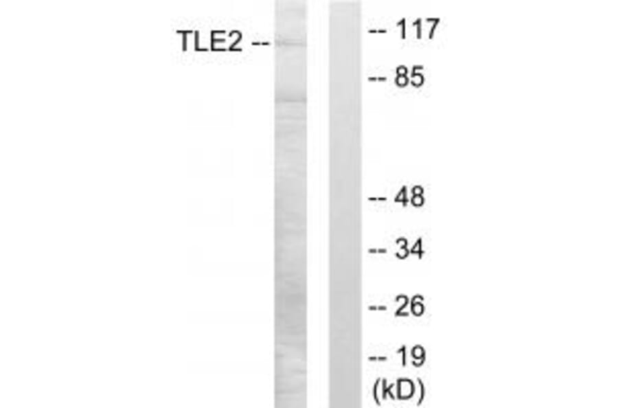 Western blot - TLE2 Antibody from Signalway Antibody (33855) - Antibodies.com