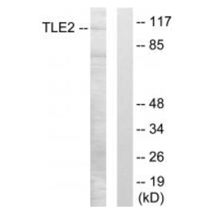 Western blot - TLE2 Antibody from Signalway Antibody (33855) - Antibodies.com