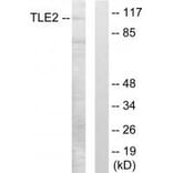 Western blot - TLE2 Antibody from Signalway Antibody (33855) - Antibodies.com