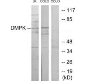 Western blot - DMPK Antibody from Signalway Antibody (33863) - Antibodies.com