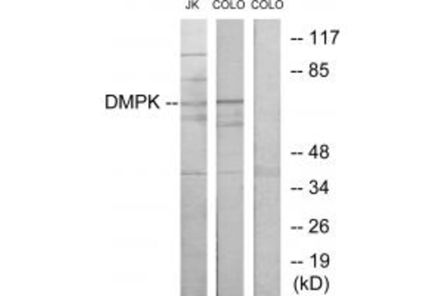 Western blot - DMPK Antibody from Signalway Antibody (33863) - Antibodies.com