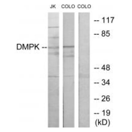 Western blot - DMPK Antibody from Signalway Antibody (33863) - Antibodies.com
