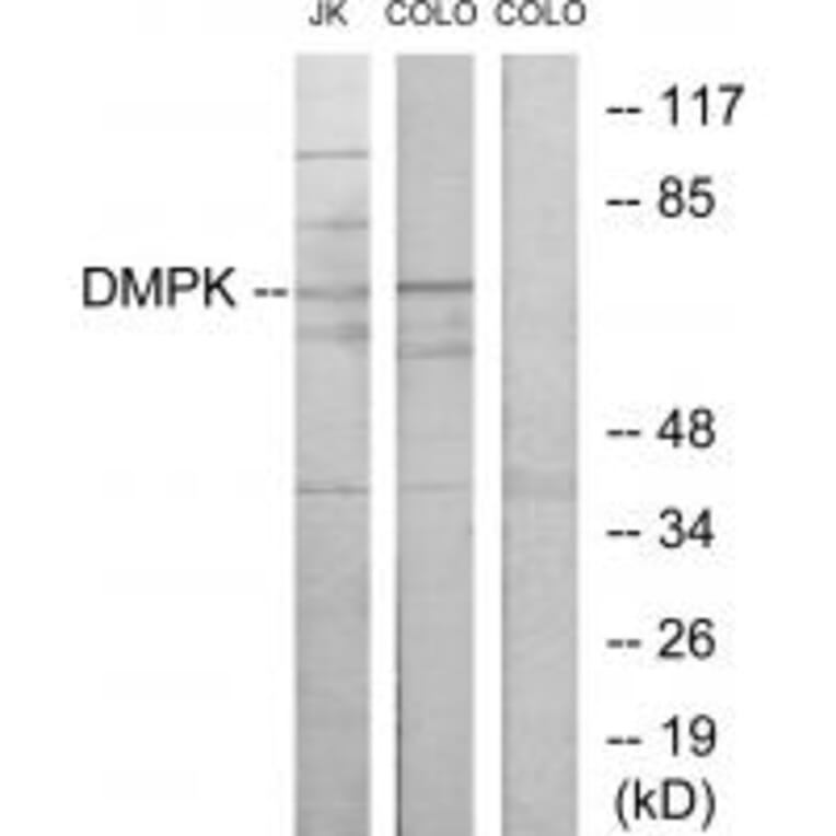 Western blot - DMPK Antibody from Signalway Antibody (33863) - Antibodies.com