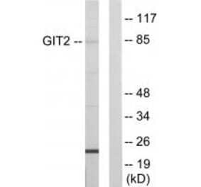 Western blot - GIT2 Antibody from Signalway Antibody (33876) - Antibodies.com