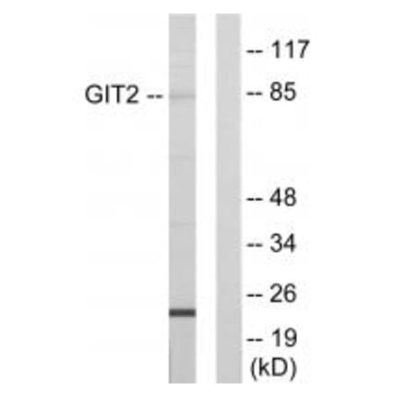 Western blot - GIT2 Antibody from Signalway Antibody (33876) - Antibodies.com