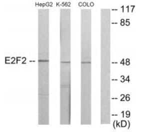Western blot - E2F2 Antibody from Signalway Antibody (33877) - Antibodies.com
