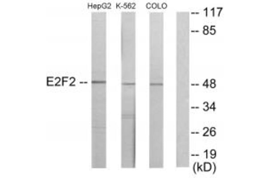 Western blot - E2F2 Antibody from Signalway Antibody (33877) - Antibodies.com