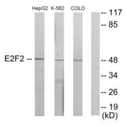 Western blot - E2F2 Antibody from Signalway Antibody (33877) - Antibodies.com