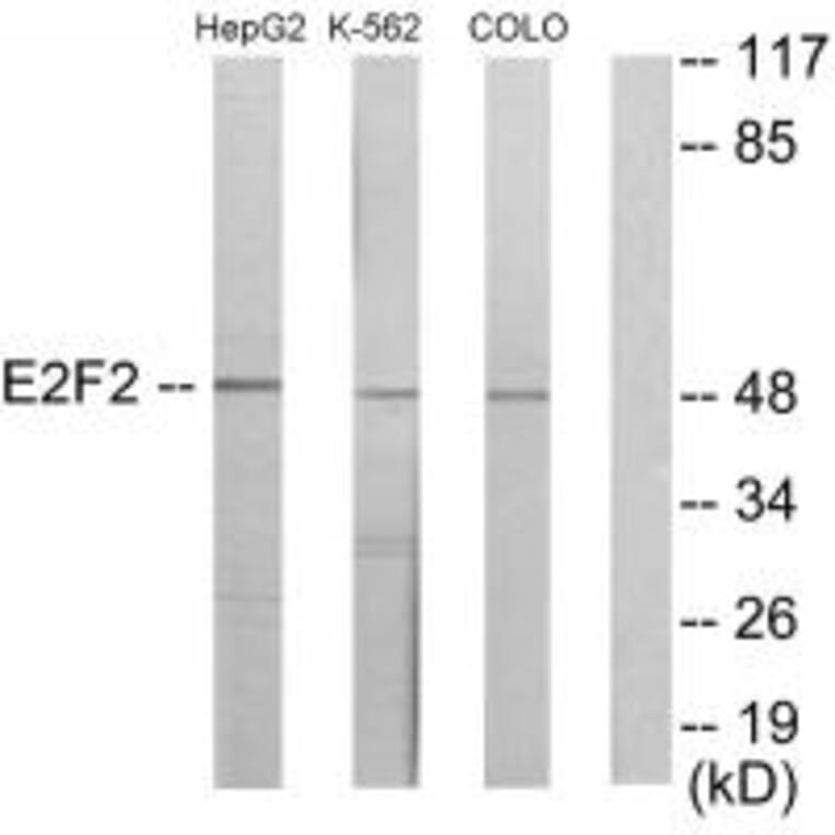 Western blot - E2F2 Antibody from Signalway Antibody (33877) - Antibodies.com