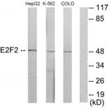 Western blot - E2F2 Antibody from Signalway Antibody (33877) - Antibodies.com