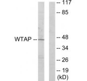 Western blot - WTAP Antibody from Signalway Antibody (33889) - Antibodies.com