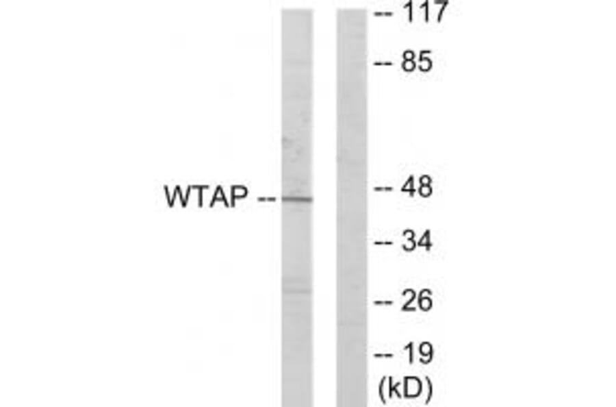 Western blot - WTAP Antibody from Signalway Antibody (33889) - Antibodies.com