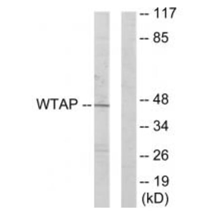 Western blot - WTAP Antibody from Signalway Antibody (33889) - Antibodies.com