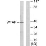 Western blot - WTAP Antibody from Signalway Antibody (33889) - Antibodies.com