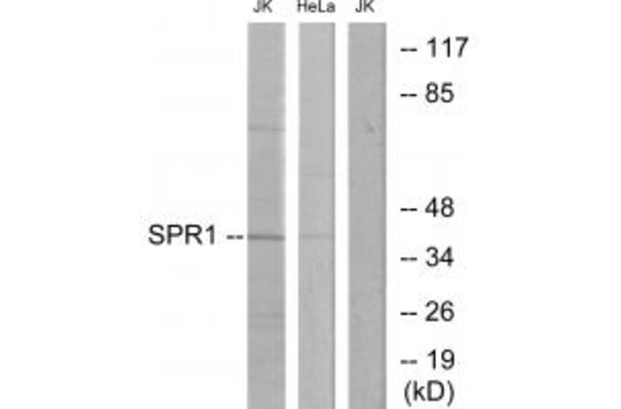 Western blot - SPR1 Antibody from Signalway Antibody (33906) - Antibodies.com