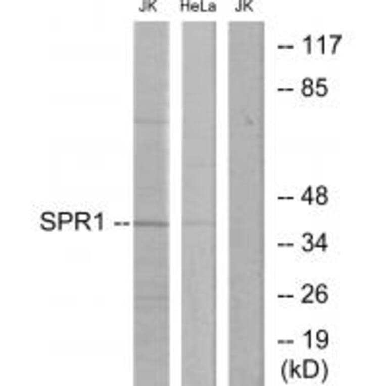 Western blot - SPR1 Antibody from Signalway Antibody (33906) - Antibodies.com