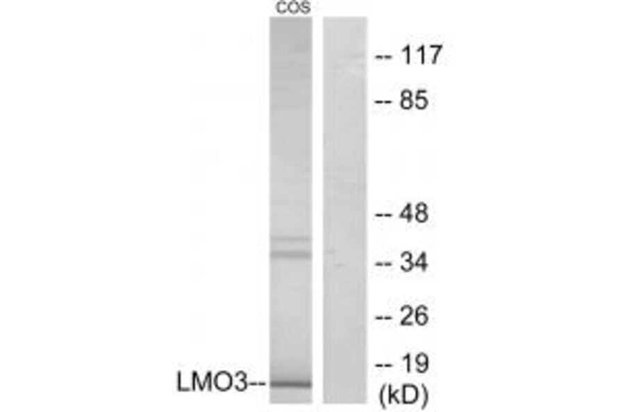 Western blot - LMO3 Antibody from Signalway Antibody (33983) - Antibodies.com