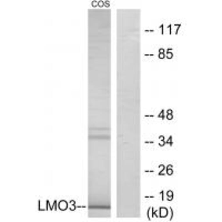 Western blot - LMO3 Antibody from Signalway Antibody (33983) - Antibodies.com