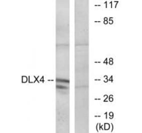 Western blot - DLX4 Antibody from Signalway Antibody (34011) - Antibodies.com
