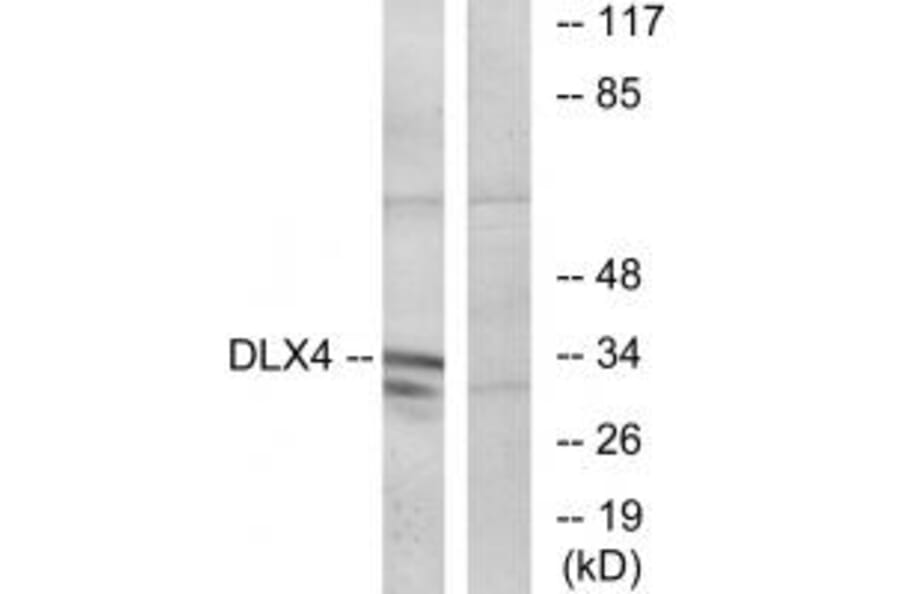 Western blot - DLX4 Antibody from Signalway Antibody (34011) - Antibodies.com