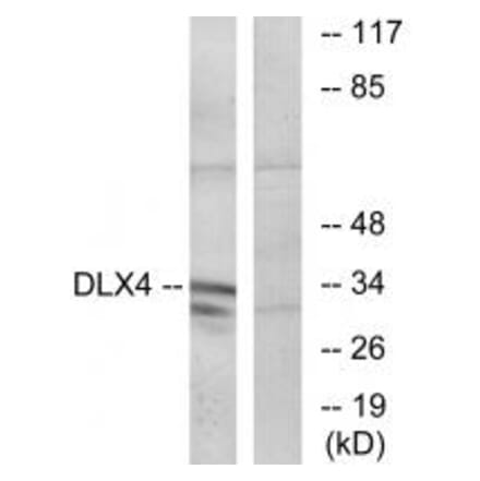 Western blot - DLX4 Antibody from Signalway Antibody (34011) - Antibodies.com