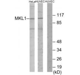 Western blot - MKL1 Antibody from Signalway Antibody (34018) - Antibodies.com