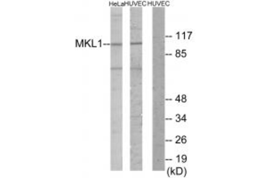 Western blot - MKL1 Antibody from Signalway Antibody (34018) - Antibodies.com