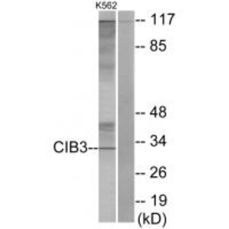 Western blot - CIB3 Antibody from Signalway Antibody (34034) - Antibodies.com