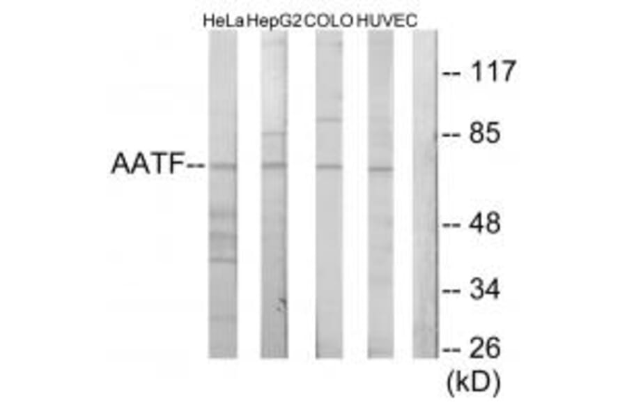 Western blot - AATF Antibody from Signalway Antibody (34082) - Antibodies.com
