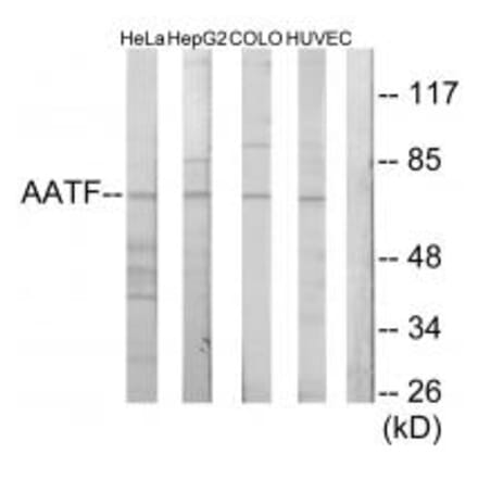 Western blot - AATF Antibody from Signalway Antibody (34082) - Antibodies.com