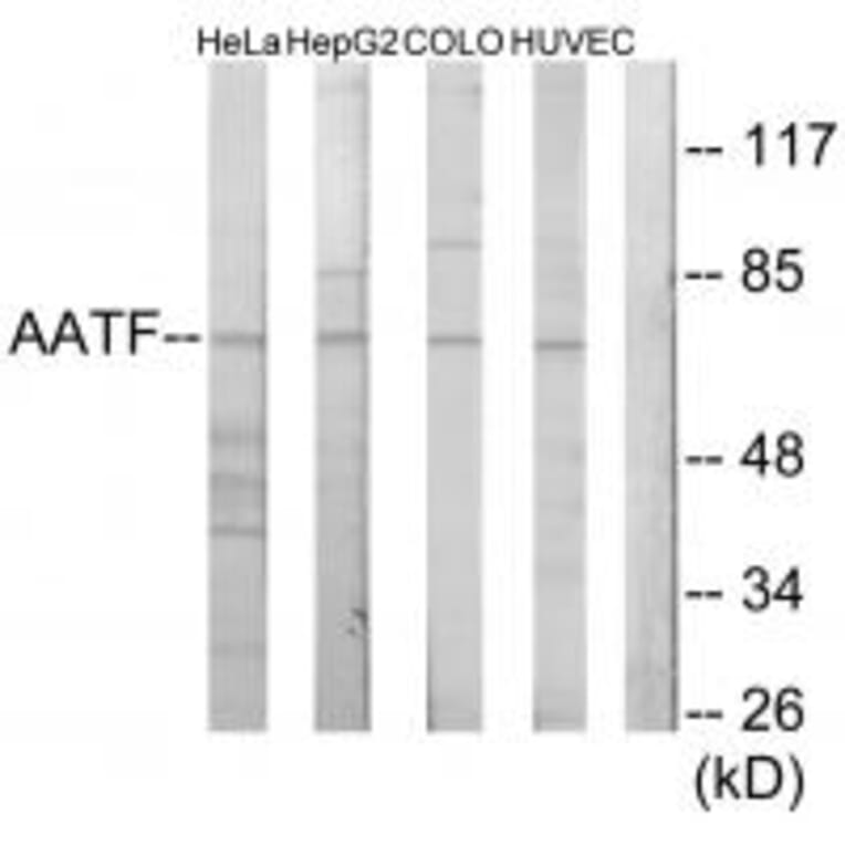 Western blot - AATF Antibody from Signalway Antibody (34082) - Antibodies.com