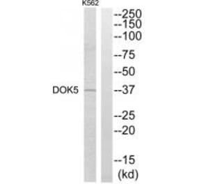 Western blot - DOK5 Antibody from Signalway Antibody (34089) - Antibodies.com