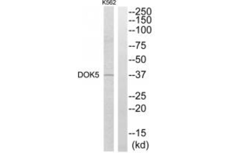 Western blot - DOK5 Antibody from Signalway Antibody (34089) - Antibodies.com