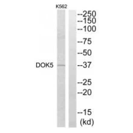 Western blot - DOK5 Antibody from Signalway Antibody (34089) - Antibodies.com