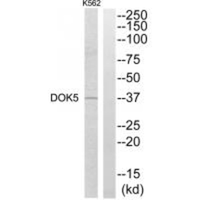 Western blot - DOK5 Antibody from Signalway Antibody (34089) - Antibodies.com