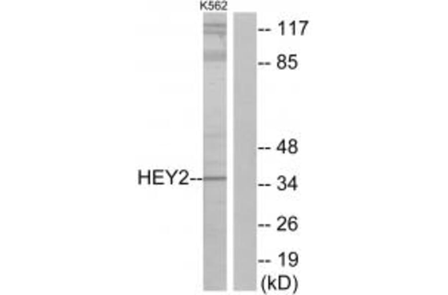 Western blot - HEY2 Antibody from Signalway Antibody (34094) - Antibodies.com