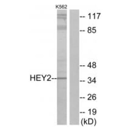 Western blot - HEY2 Antibody from Signalway Antibody (34094) - Antibodies.com