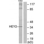 Western blot - HEY2 Antibody from Signalway Antibody (34094) - Antibodies.com