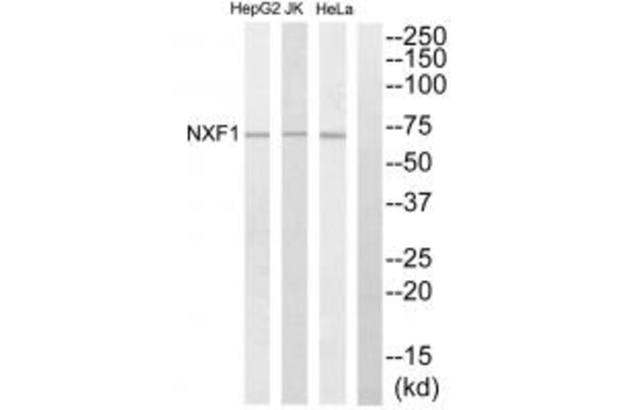 Western blot - NXF1 Antibody from Signalway Antibody (34096) - Antibodies.com
