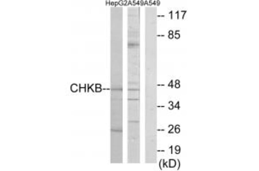 Western blot - CHKB Antibody from Signalway Antibody (34125) - Antibodies.com