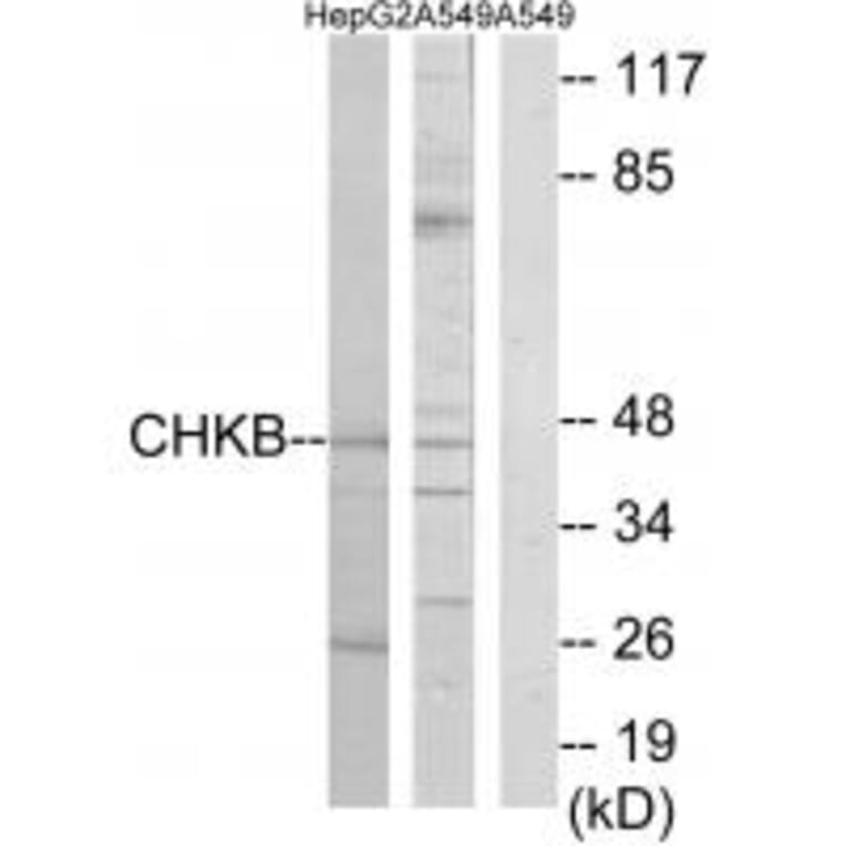 Western blot - CHKB Antibody from Signalway Antibody (34125) - Antibodies.com