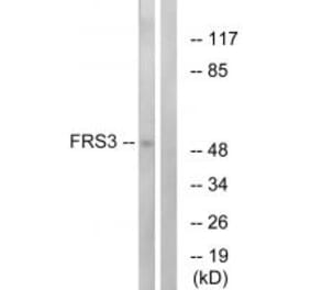 Western blot - FRS3 Antibody from Signalway Antibody (34249) - Antibodies.com