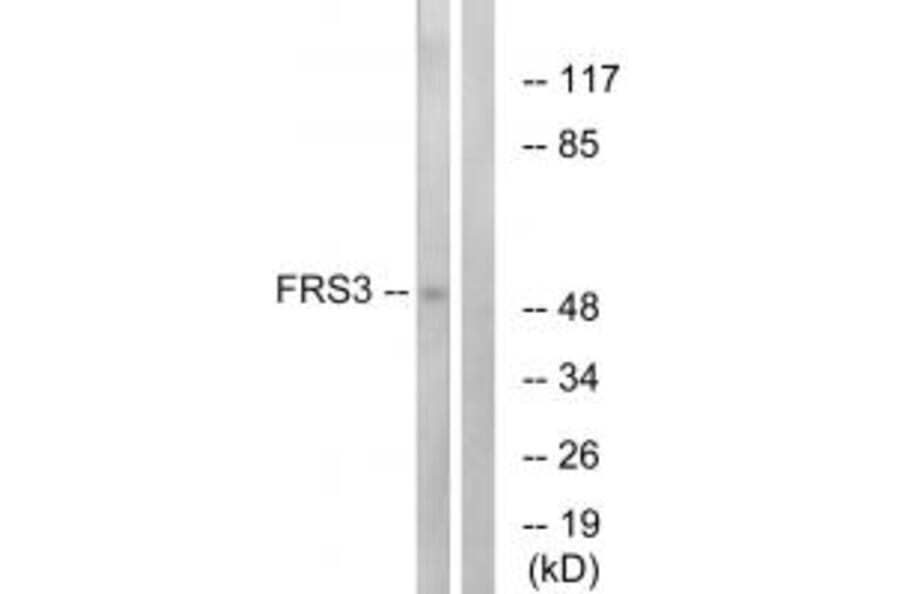 Western blot - FRS3 Antibody from Signalway Antibody (34249) - Antibodies.com