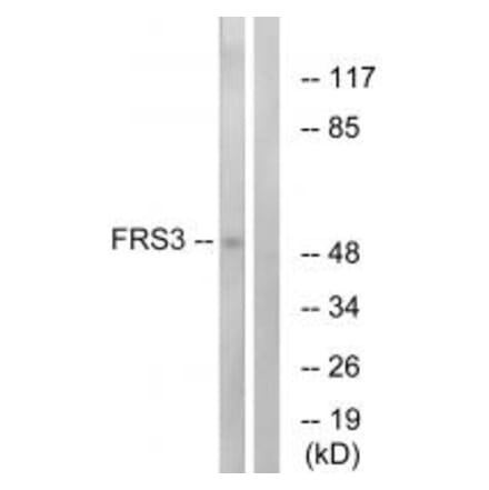 Western blot - FRS3 Antibody from Signalway Antibody (34249) - Antibodies.com