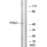 Western blot - FRS3 Antibody from Signalway Antibody (34249) - Antibodies.com
