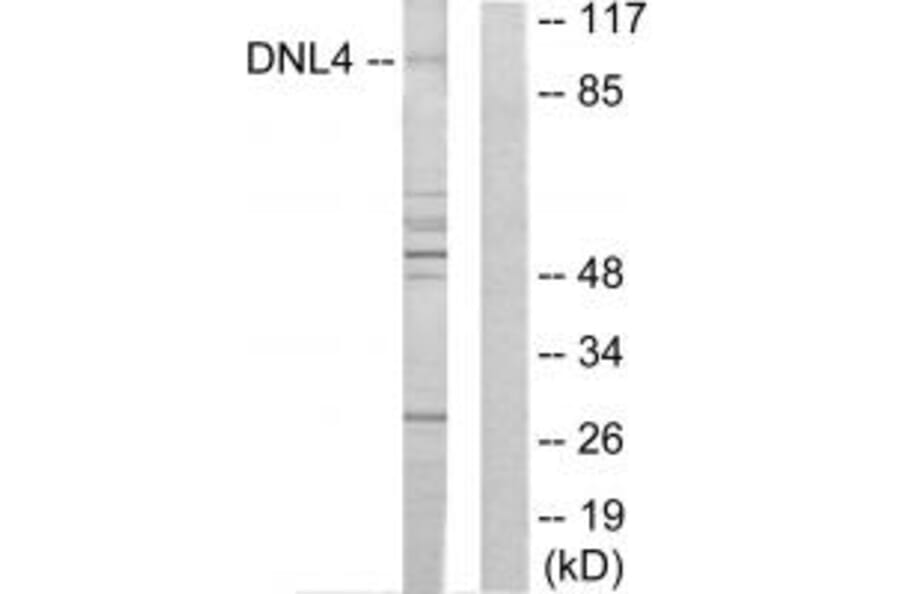 Western blot - DNL4 Antibody from Signalway Antibody (34266) - Antibodies.com