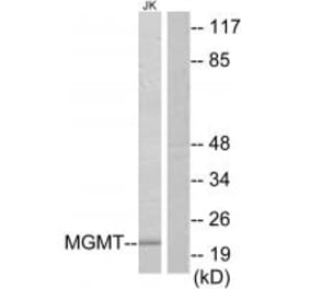 Western blot - MGMT Antibody from Signalway Antibody (34286) - Antibodies.com