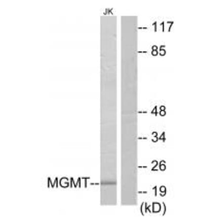 Western blot - MGMT Antibody from Signalway Antibody (34286) - Antibodies.com