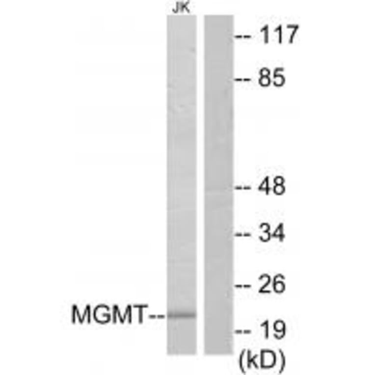 Western blot - MGMT Antibody from Signalway Antibody (34286) - Antibodies.com